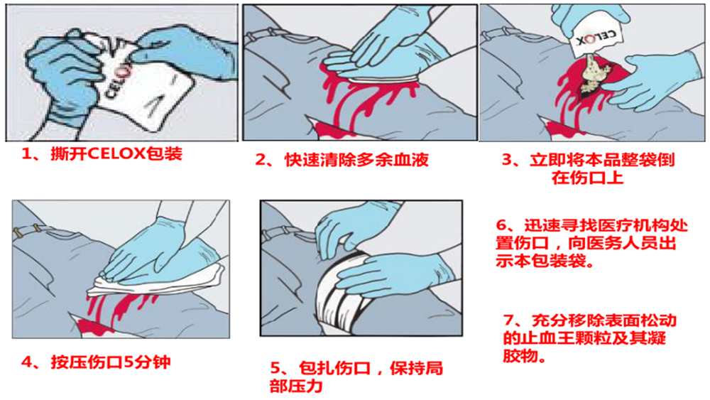 警用急救箱止血王